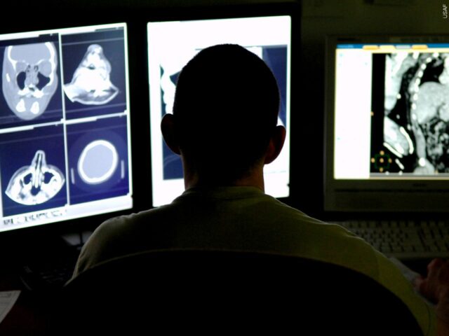 Racism linked to Alzheimer’s, dementia in Blacks