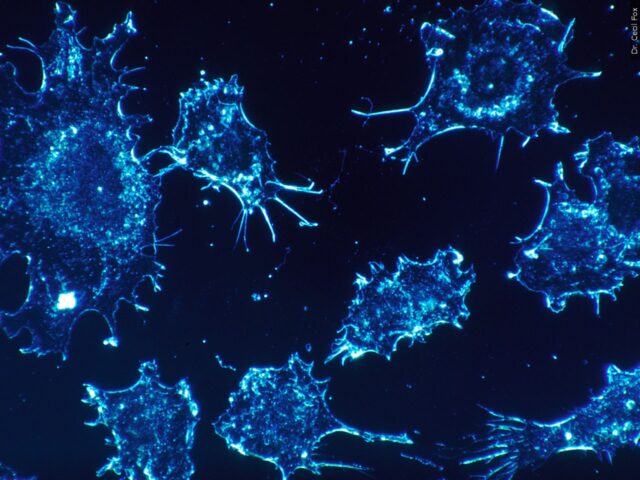 Significant increases in cancer mortality after COVID mRNA vaccination, Japanese researchers find