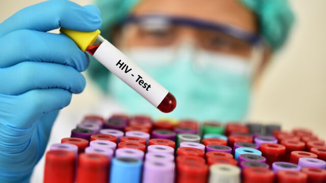 Blacks still disproportionately impacted by HIV/AIDS 44 years into the epidemic